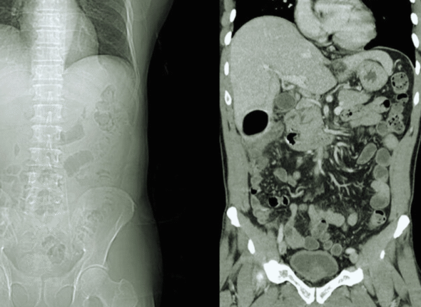ct abdomen anatomy